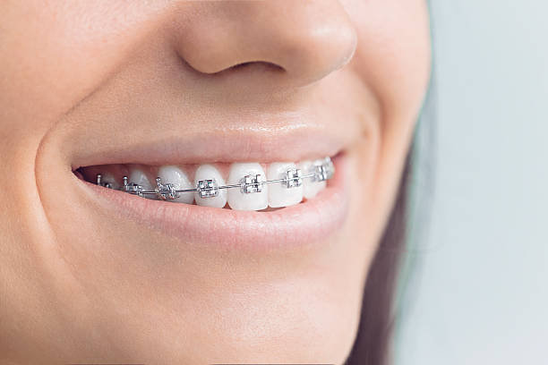 Best Oral Cancer Screening  in Mendota, IL
